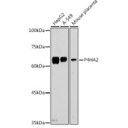 Western blot analysis of various lysates using P4HA2 Antibody at 1/500 dilution. Secondary antibody: HRP-conjugated Goat anti-Rabbit IgG (H+L) at 1/10000 dilution. Lysates/proteins: 25 µg per lane. Blocking buffer: 3% nonfat dry milk in TBST. Exposure time: 1s.