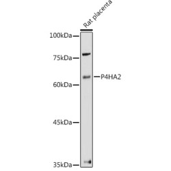 Prolyl 4-Hydroxylase Subunit Alpha-2 (P4HA2) Antibody