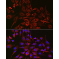 Prolyl 4-Hydroxylase Subunit Alpha-2 (P4HA2) Antibody