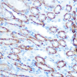 Lon Protease Homolog, Mitochondrial (LONP1) Antibody