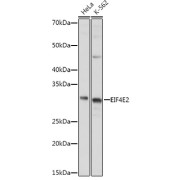 Western blot analysis of various lysates using EIF4E2 Antibody at 1/1000 dilution. Secondary antibody: HRP-conjugated Goat anti-Rabbit IgG (H+L) at 1/10000 dilution. Lysates/proteins: 25 µg per lane. Blocking buffer: 3% nonfat dry milk in TBST. Exposure time: 2s.