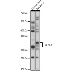 Eukaryotic Translation Initiation Factor 4E Type 2 (EIF4E2) Antibody