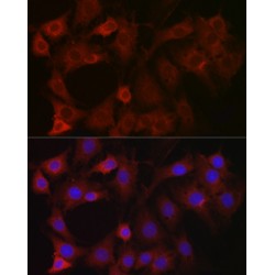 Eukaryotic Translation Initiation Factor 4E Type 2 (EIF4E2) Antibody