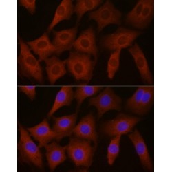 Eukaryotic Translation Initiation Factor 4E Type 2 (EIF4E2) Antibody