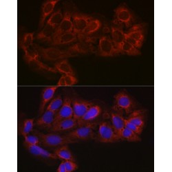 Eukaryotic Translation Initiation Factor 4E Type 2 (EIF4E2) Antibody