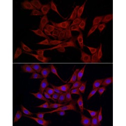 Protein Disulfide-Isomerase A4 (PDIA4) Antibody