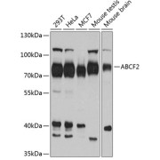 Western blot analysis of various lysates using ABCF2 Antibody at 1/1000 dilution. Secondary antibody: HRP-conjugated Goat anti-Rabbit IgG (H+L) at 1/10000 dilution. Lysates/proteins: 25 µg per lane. Blocking buffer: 3% nonfat dry milk in TBST. Exposure time: 60s.