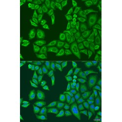 ATP Binding Cassette Subfamily F Member 2 (ABCF2) Antibody