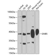 Western blot analysis of various lysates using GNB5 Antibody at 1/1000 dilution. Secondary antibody: HRP-conjugated Goat anti-Rabbit IgG (H+L) at 1/10000 dilution. Lysates/proteins: 25 µg per lane. Blocking buffer: 3% nonfat dry milk in TBST. Exposure time: 60s.