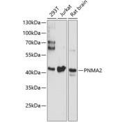 Western blot analysis of various lysates using PNMA2 Antibody at 1/3000 dilution. Secondary antibody: HRP-conjugated Goat anti-Rabbit IgG (H+L) at 1/10000 dilution. Lysates/proteins: 25 µg per lane. Blocking buffer: 3% nonfat dry milk in TBST. Exposure time: 90s.