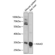 Western blot analysis of various lysates using HAAO Antibody at 1/3000 dilution. Secondary antibody: HRP-conjugated Goat anti-Rabbit IgG (H+L) at 1/10000 dilution. Lysates/proteins: 25 µg per lane. Blocking buffer: 3% nonfat dry milk in TBST. Exposure time: 1s.