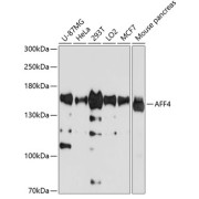 Western blot analysis of various lysates using AFF4 Antibody at 1/1000 dilution. Secondary antibody: HRP-conjugated Goat anti-Rabbit IgG (H+L) at 1/10000 dilution. Lysates/proteins: 25 µg per lane. Blocking buffer: 3% nonfat dry milk in TBST. Detection: ECL Basic Kit (RM00020). Exposure time: 30s.