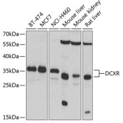 Western blot analysis of various lysates using DCXR Antibody at 1/1000 dilution. Secondary antibody: HRP-conjugated Goat anti-Rabbit IgG (H+L) at 1/10000 dilution. Lysates/proteins: 25 µg per lane. Blocking buffer: 3% nonfat dry milk in TBST. Exposure time: 5s.