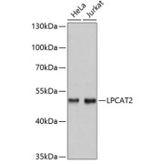 Western blot analysis of various lysates using LPCAT2 Antibody at 1/3000 dilution. Secondary antibody: HRP-conjugated Goat anti-Rabbit IgG (H+L) at 1/10000 dilution. Lysates/proteins: 25 µg per lane. Blocking buffer: 3% nonfat dry milk in TBST. Exposure time: 10s.