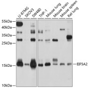 Western blot analysis of various lysates using EIF5A2 Antibody at 1/1000 dilution. Secondary antibody: HRP-conjugated Goat anti-Rabbit IgG (H+L) at 1/10000 dilution. Lysates/proteins: 25 µg per lane. Blocking buffer: 3% nonfat dry milk in TBST. Exposure time: 30s.