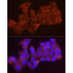 Lysophosphatidylcholine Acyltransferase 1 (LPCAT1) Antibody