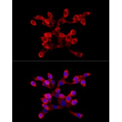 La-Related Protein 4 (LARP4) Antibody