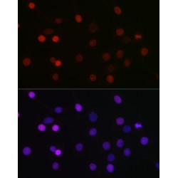 Lysine Methyltransferase 5A (SETD8) Antibody