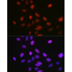 Lysine Methyltransferase 5A (SETD8) Antibody