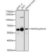 Western blot analysis of various lysates using NONO/p54nrb Antibody at 1/1000 dilution. Secondary antibody: HRP-conjugated Goat anti-Rabbit IgG (H+L) at 1/10000 dilution. Lysates/proteins: 25 µg per lane. Blocking buffer: 3% nonfat dry milk in TBST. Exposure time: 10s.