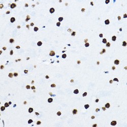 Non POU Domain Containing Octamer Binding Protein (NONO) Antibody