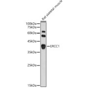 Western blot analysis of lysates from Rat skeletal muscle, using ERCC1 Antibody at 1/1000 dilution. Secondary antibody: HRP-conjugated Goat anti-Rabbit IgG (H+L) at 1/10000 dilution. Lysates/proteins: 25 µg per lane. Blocking buffer: 3% nonfat dry milk in TBST. Exposure time: 180s.