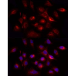 Somatoliberin (GHRH) Antibody