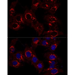 Golgin A2 (GOLGA2) Antibody