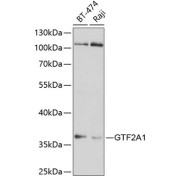 Western blot analysis of various lysates using GTF2A1 Antibody at 1/1000 dilution. Secondary antibody: HRP-conjugated Goat anti-Rabbit IgG (H+L) at 1/10000 dilution. Lysates/proteins: 25 µg per lane. Blocking buffer: 3% nonfat dry milk in TBST. Exposure time: 20s.