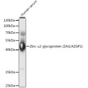 Western blot analysis of lysates from human serum, using Zinc-α2-glycoprotein (ZAG/AZGP1) Antibody at 1/1000 dilution. Secondary antibody: HRP-conjugated Goat anti-Rabbit IgG (H+L) at 1/10000 dilution. Lysates/proteins: 25 µg per lane. Blocking buffer: 3% nonfat dry milk in TBST. Exposure time: 1s.