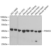 Western blot analysis of various lysates using PSMC6 Antibody at 1/1000 dilution. Secondary antibody: HRP-conjugated Goat anti-Rabbit IgG (H+L) at 1/10000 dilution. Lysates/proteins: 25 µg per lane. Blocking buffer: 3% nonfat dry milk in TBST. Exposure time: 90s.