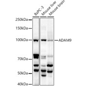 Western blot analysis of various lysates using ADAM9 Antibody at 1/1000 dilution. Secondary antibody: HRP-conjugated Goat anti-Rabbit IgG (H+L) at 1/10000 dilution. Lysates/proteins: 25 µg per lane. Blocking buffer: 3% nonfat dry milk in TBST. Exposure time: 180s.