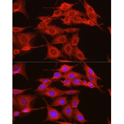 ADAM Metallopeptidase Domain 9 (ADAM9) Antibody