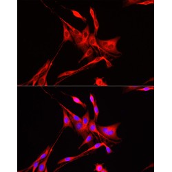 ADAM Metallopeptidase Domain 9 (ADAM9) Antibody