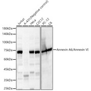 Western blot analysis of various lysates, using Annexin A6/Annexin VI Antibody at 1/6000 dilution. Secondary antibody: HRP-conjugated Goat anti-Rabbit IgG (H+L) at 1/10000 dilution. Lysates/proteins: 25 µg per lane. Blocking buffer: 3% nonfat dry milk in TBST. Exposure time: 30s.