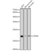 Western blot analysis of various lysates using [KO Validated] CETN2 Antibody at 1/1000 dilution. Secondary antibody: HRP-conjugated Goat anti-Rabbit IgG (H+L) at 1/10000 dilution. Lysates/proteins: 25 µg per lane. Blocking buffer: 3% nonfat dry milk in TBST. Exposure time: 180s.