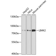 Western blot analysis of various lysates using LIMK2 Antibody at 1/1000 dilution. Secondary antibody: HRP-conjugated Goat anti-Rabbit IgG (H+L) at 1/10000 dilution. Lysates/proteins: 25 µg per lane. Blocking buffer: 3% nonfat dry milk in TBST. Exposure time: 90s.