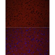 Immunofluorescence analysis of paraffin-embedded rat brain using STXBP1 Antibody at dilution of 1/50. Secondary antibody: Cy3-conjugated Goat anti-Rabbit IgG (H+L) at 1/500 dilution. Blue: DAPI for nuclear staining.