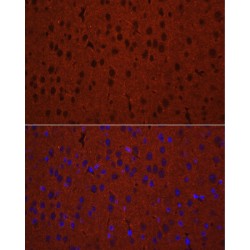 Syntaxin Binding Protein 1 (STXBP1) Antibody