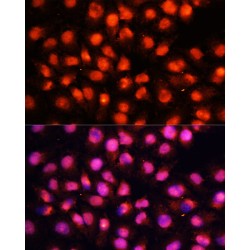 Syntaxin Binding Protein 1 (STXBP1) Antibody