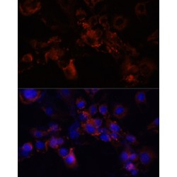 Syntaxin Binding Protein 1 (STXBP1) Antibody