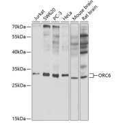 Western blot analysis of various lysates using ORC6 Antibody at 1/1000 dilution. Secondary antibody: HRP-conjugated Goat anti-Rabbit IgG (H+L) at 1/10000 dilution. Lysates/proteins: 25 µg per lane. Blocking buffer: 3% nonfat dry milk in TBST. Exposure time: 30s.