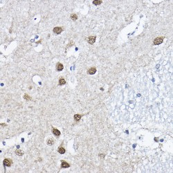 Origin Recognition Complex Subunit 6 (ORC6) Antibody