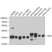 Western blot analysis of various lysates using CBR1 Antibody at 1/1000 dilution. Secondary antibody: HRP-conjugated Goat anti-Rabbit IgG (H+L) at 1/10000 dilution. Lysates/proteins: 25 µg per lane. Blocking buffer: 3% nonfat dry milk in TBST. Exposure time: 5s.