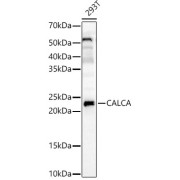 Western blot analysis of lysates from 293T cells, using CALCA Antibody at 1/2500 dilution. Secondary antibody: HRP-conjugated Goat anti-Rabbit IgG (H+L) at 1/10000 dilution. Lysates/proteins: 25 µg per lane. Blocking buffer: 3% nonfat dry milk in TBST. Exposure time: 30s.