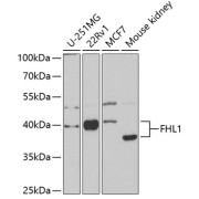 Western blot analysis of various lysates using FHL1 Antibody at 1/1000 dilution. Secondary antibody: HRP-conjugated Goat anti-Rabbit IgG (H+L) at 1/10000 dilution. Lysates/proteins: 25 µg per lane. Blocking buffer: 3% nonfat dry milk in TBST. Exposure time: 90s.