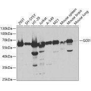 Western blot analysis of various lysates using GDI1 Antibody at 1/1000 dilution. Secondary antibody: HRP-conjugated Goat anti-Rabbit IgG (H+L) at 1/10000 dilution. Lysates/proteins: 25 µg per lane. Blocking buffer: 3% nonfat dry milk in TBST. Exposure time: 5s.