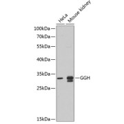 Western blot analysis of various lysates using GGH Antibody at 1/1000 dilution. Secondary antibody: HRP-conjugated Goat anti-Rabbit IgG (H+L) at 1/10000 dilution. Lysates/proteins: 25 µg per lane. Blocking buffer: 3% nonfat dry milk in TBST. Exposure time: 90s.