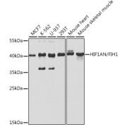 Western blot analysis of various lysates using [KO Validated] HIF1AN/FIH1 Antibody at 1/1000 dilution. Secondary antibody: HRP-conjugated Goat anti-Rabbit IgG (H+L) at 1/10000 dilution. Lysates/proteins: 25 µg per lane. Blocking buffer: 3% nonfat dry milk in TBST. Exposure time: 30s.