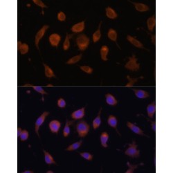 Hypoxia Inducible Factor 1 Alpha Inhibitor (HIF1AN) Antibody